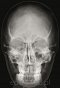Zdjęcia rentgenowskie - czaszka.