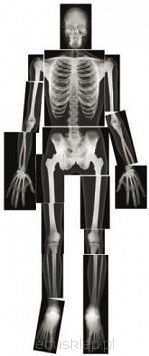 Zdjęcia rentgenowskie - szkielet człowieka.